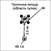 Акупунктура без иголок. Акупрессура. Точечный массаж