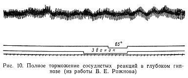 Гипноз и религия