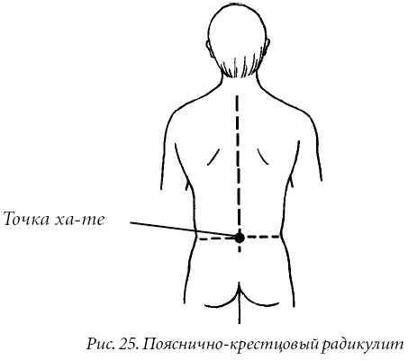 Лечение спины и суставов. Лучшие рецепты народной медицины от А до Я