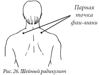 Лечение спины и суставов. Лучшие рецепты народной медицины от А до Я